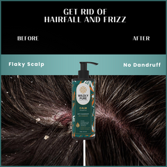 Wildly Pure Calm Anti Dandruff Shampoo for itchy & flaky scalp with Piroctone Olamine & Aloe Vera Leaf Juice (150 ml)