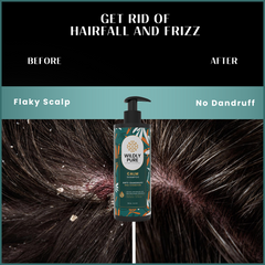 Wildly Pure Calm Anti Dandruff Shampoo for itchy & flaky scalp with Piroctone Olamine & Aloe Vera Leaf Juice (300 ml)