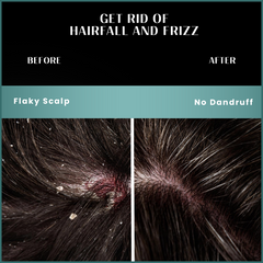 Hairfall Control SHAMPOO & CONDITIONER Combo for Dry Damaged Hair